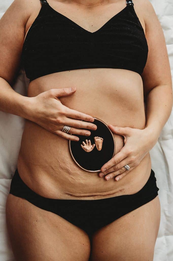 Life and Loss and Postpartum
