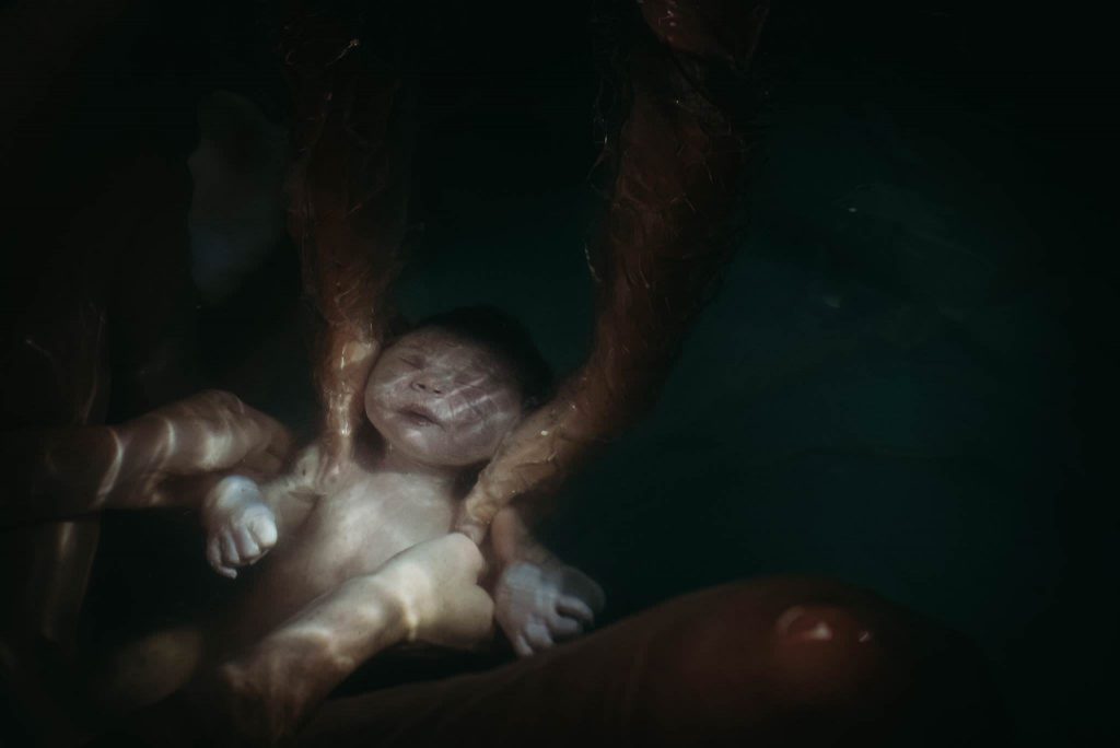 Birth Photography - Experience 48 of the most powerful Birth Photos